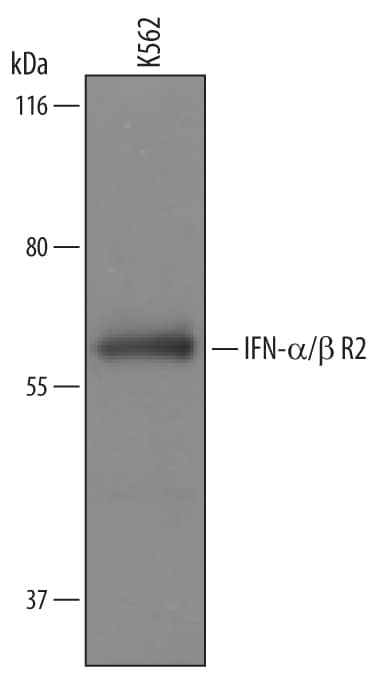 Western blot shows lysates of K562 human chronic myelogenous leukemia cell line. PVDF Membrane was probed with 1 µg/mL of Human IFN-a/ beta  R2 Antigen Affinity-purified Polyclonal Antibody (Catalog # AF4015) followed by HRP-conjugated Anti-Goat IgG Secondary Antibody (Catalog # HAF019). A specific band was detected for IFN-a/ beta  R2 at approximately 58 kDa (as indicated). This experiment was conducted under reducing conditions and using Immunoblot Buffer Group 1.