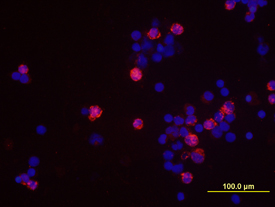 IFN-gamma was detected in immersion fixed human peripheral blood mononuclear cells (PBMCs) stimulated with PMA and ionomycin using 10 µg/mL Goat Anti-Human IFN-gamma Antigen Affinity-purified Polyclonal Antibody (Catalog # AF-285-NA) for 3 hours at room temperature. Cells were stained with the NorthernLights™ 557-conjugated Anti-Goat IgG Secondary Antibody (red); (NL001) and counterstained with DAPI (blue). View our protocol for Fluorescent ICC Staining of Non-adherent Cells.