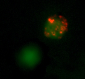 IFN‑ gamma  was detected in immersion fixed PMA- and ionomycin-stimulated human peripheral blood mononuclear cells (PBMCs) using 10 &micro;g/mL Goat Anti-Human IFN‑ gamma  Biotinylated Antigen Affinity-purified Polyclonal Antibody (Catalog # BAF285) for 3 hours at room temperature. Cells were stained (red) and counterstained (green). View our protocol for Fluorescent ICC Staining of Non-adherent Cells.