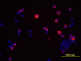 IFN-gamma  was detected in immersion fixed human peripheral blood mononuclear cells (PBMCs) stimulated with PMA and ionomycin using 10 µg/mL Human IFN-gamma  Monoclonal Antibody (Catalog # MAB285) for 3 hours at room temperature. Cells were stained with the NorthernLights™ 557-conjugated Anti-Mouse IgG Secondary Antibody (red; Catalog # NL007) and counterstained with DAPI (blue). View our protocol for Fluorescent ICC Staining of Non-adherent Cells.