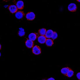 IFN-a2/IFNA2 was detected in immersion fixed human peripheral blood mononuclear cells (PBMCs) using Mouse Anti-Human IFN-a2/IFNA2 Monoclonal Antibody (Catalog # MAB93455) at 8 µg/mL for 3 hours at room temperature. Cells were stained using the NorthernLights™ 557-conjugated Anti-Mouse IgG Secondary Antibody (red; Catalog # NL007) and counterstained with DAPI (blue). Specific staining was localized to cell surfaces. View our protocol for Fluorescent ICC Staining of Non-adherent Cells.