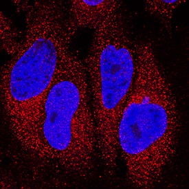 IFN-a2/IFNA2 was detected in immersion fixed HeLa human cervical epithelial carcinoma cell line using Mouse Anti-Human IFN-a2/IFNA2 Monoclonal Antibody (Catalog # MAB9345) at 8 µg/mL for 3 hours at room temperature. Cells were stained using the NorthernLights™ 557-conjugated Anti-Mouse IgG Secondary Antibody (red; Catalog # NL007) and counterstained with DAPI (blue). Specific staining was localized to cytoplasm. View our protocol for Fluorescent ICC Staining of Cells on Coverslips.