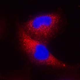 IFN-beta  was detected in immersion fixed A549 human lung carcinoma cell line using Mouse Anti-Human IFN-beta  Monoclonal Antibody (Catalog # MAB8141) at 8 µg/mL for 3 hours at room temperature. Cells were stained using the NorthernLights™ 557-conjugated Anti-Mouse IgG Secondary Antibody (red; Catalog # NL007) and counterstained with DAPI (blue). Specific staining was localized to cytoplasm. View our protocol for Fluorescent ICC Staining of Cells on Coverslips.