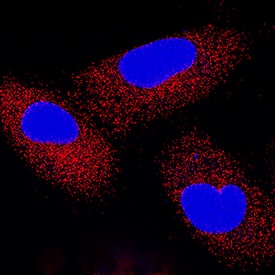 IFN-beta  was detected in immersion fixed A549 human lung carcinoma cell line using Rabbit Anti-Human IFN-beta  Monoclonal Antibody (Catalog # MAB8142) at 1 µg/mL for 3 hours at room temperature. Cells were stained using the NorthernLights™ 557-conjugated Anti-Rabbit IgG Secondary Antibody (red; NL004) and counterstained with DAPI (blue). Specific staining was localized to cytoplasm. View our protocol for Fluorescent ICC Staining of Cells on Coverslips.