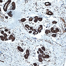 IFN-beta  was detected in immersion fixed paraffin-embedded sections of human breast using Mouse Anti-Human IFN-beta  Monoclonal Antibody (Catalog # MAB8145) at 5 µg/mL for 1 hour at room temperature followed by incubation with the Anti-Mouse IgG VisUCyte™ HRP Polymer Antibody (Catalog # VC001). Before incubation with the primary antibody, tissue was subjected to heat-induced epitope retrieval using Antigen Retrieval Reagent-Basic (Catalog # CTS013). Tissue was stained using DAB (brown) and counterstained with hematoxylin (blue). Specific staining was localized to cytoplasm in ductal cells. View our protocol for IHC Staining with VisUCyte HRP Polymer Detection Reagents.