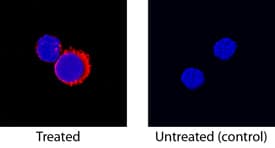 IGFBP-1 was detected in immersion fixed canine peripheral blood mononuclear cells (PBMCs) stimulated with PMA and calcium ionomycin using Goat Anti-Human IGFBP-1 Biotinylated Antigen Affinity-purified Polyclonal Antibody (Catalog # BAF871) at 15 µg/mL for 3 hours at room temperature. Cells were stained using the NorthernLights™ 557-conjugated Streptavidin (red; Catalog # NL999) and counterstained with DAPI (blue). Specific staining was localized to cytoplasm. View our protocol for Fluorescent ICC Staining of Non-adherent Cells.