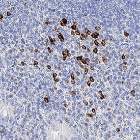 <b>Biological Strategies Validation. </b>IFN-gamma was detected in immersion fixed paraffin-embedded sections of human appendix tissue using Rabbit Anti-Human IFN-gamma Monoclonal Antibody (Catalog # MAB2853) at 5 µg/mL for 1 hour at room temperature followed by incubation with the Anti-Rabbit IgG VisUCyte™ HRP Polymer Antibody (Catalog # VC003). Before incubation with the primary antibody, tissue was subjected to heat-induced epitope retrieval using Antigen Retrieval Reagent-Basic (Catalog # CTS013). Tissue was stained using DAB (brown) and counterstained with hematoxylin (blue). Specific staining was localized to cytoplasm in lymphocytes. View our protocol for IHC Staining with VisUCyte HRP Polymer Detection Reagents.