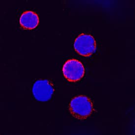 IFN-gamma R1/CD119 was detected in immersion fixed human peripheral blood mononuclear cells (PBMCs) using Goat Anti-Human IFN-gamma R1/CD119 Antigen Affinity-purified Polyclonal Antibody (Catalog # AF673) at 15 µg/mL for 3 hours at room temperature. Cells were stained using the NorthernLights™ 557-conjugated Anti-Goat IgG Secondary Antibody (red; Catalog # NL001) and counterstained with DAPI (blue). Specific staining was localized to plasma membrane. View our protocol for Fluorescent ICC Staining of Non-adherent Cells.