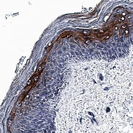 Immunohistochemistry IFN-kappa Antibody (1009725) [Unconjugated]