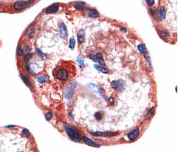 IGF-II/IGF2 was detected in immersion fixed paraffin-embedded sections of human placenta (chorionic villi) using 5 µg/mL Goat Anti-Human IGF-II/IGF2 Antigen Affinity-purified Polyclonal Antibody (Catalog # AF-292-NA) overnight at 4 °C. Before incubation with the primary antibody tissue was subjected to heat-induced epitope retrieval using Antigen Retrieval Reagent-Basic (Catalog # CTS013). Tissue was stained with the Anti-Goat HRP-AEC Cell & Tissue Staining Kit (red; Catalog # CTS009) and counterstained with hematoxylin (blue). View our protocol for Chromogenic IHC Staining of Paraffin-embedded Tissue Sections.
