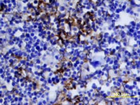 IGF-II/IGF2 was detected in immersion fixed frozen sections of mouse embryo (E13-17) using Mouse IGF-II/IGF2 Antigen Affinity-purified Polyclonal Antibody (Catalog # AF792) at 15 µg/mL overnight at 4 °C. Tissue was stained using the Anti-Goat HRP-DAB Cell & Tissue Staining Kit (brown; Catalog # CTS008) and counterstained with hematoxylin (blue). View our protocol for Chromogenic IHC Staining of Frozen Tissue Sections.