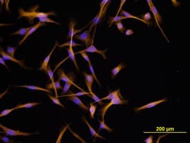 Immunocytochemistry IGF-I/IGF-1 Antibody [Unconjugated]
