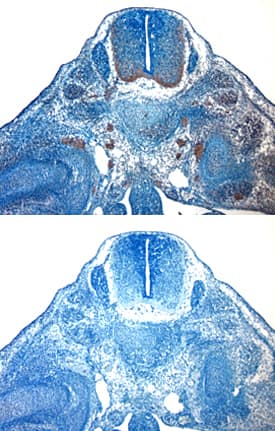 Immunohistochemistry IGF-I/IGF-1 Antibody [Unconjugated]