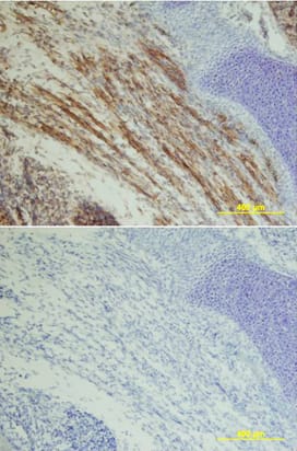 IGF-I R/IGF1R was detected in immersion fixed frozen sections of mouse embryo using Goat Anti-Human IGF-I R Antigen Affinity-purified Polyclonal Antibody (Catalog # AF-305-NA) at 10 µg/mL overnight at 4 °C. Tissue was stained using the Anti-Goat HRP-DAB Cell & Tissue Staining Kit (brown; Catalog # CTS008) and counterstained with hematoxylin (blue). Lower panel shows a lack of labeling if primary antibodies are omitted and tissue is stained only with secondary antibody followed by incubation with detection reagents. View our protocol for Chromogenic IHC Staining of Frozen Tissue Sections.