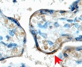 IGF-I R/IGF1R was detected in immersion fixed paraffin-embedded sections of human placenta (chorionic villi) using 15 µg/mL Goat Anti-Human IGF-I R/IGF1R Antigen Affinity-purified Polyclonal Antibody (Catalog # AF-305-NA) overnight at 4 °C. Tissue was stained with the Anti-Goat HRP-DAB Cell & Tissue Staining Kit (brown; Catalog # CTS008) and counterstained with hematoxylin (blue). View our protocol for Chromogenic IHC Staining of Paraffin-embedded Tissue Sections.