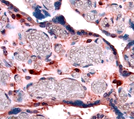 Human IGFBP-4 Antibody (Catalog # AF804) neutralizes IGFBP-4 inhibition of IGF-II-dependent proliferation in the MCF-7 human breast cancer cell line. Karey, K. P. et al. (1988) Cancer Research 48:4083. The Neutralization Dose (ND50) is typically CTS013). Tissue was stained with the Anti-Goat HRP-AEC Cell & Tissue Staining Kit (red; CTS009) and counterstained with hematoxylin (blue). View our protocol for Chromogenic IHC Staining of Paraffin-embedded Tissue Sections.