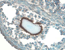 Immunohistochemistry IGFBP-5 Antibody