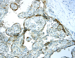 IGFBP-5 was detected in immersion fixed paraffin-embedded sections of human placenta using 25 µg/mL Human IGFBP-5 Monoclonal Antibody (Catalog # MAB875) overnight at 4 °C. Tissue was stained with the Anti-Mouse HRP-DAB Cell & Tissue Staining Kit (brown; Catalog # CTS002) and counterstained with hematoxylin (blue). View our protocol for Chromogenic IHC Staining of Paraffin-embedded Tissue Sections.