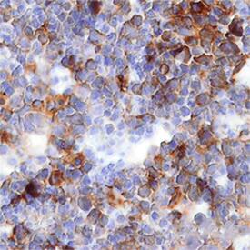 IGFBP-1 was detected in immersion fixed frozen sections of mouse embryo (13 d.p.c.) using Goat Anti-Mouse IGFBP-1 Antigen Affinity-purified Polyclonal Antibody (Catalog # AF1240) at 15 µg/mL overnight at 4 °C. Tissue was stained using the Anti-Goat HRP-DAB Cell & Tissue Staining Kit (brown; Catalog # CTS008) and counterstained with hematoxylin (blue). Specific staining was localized to developing liver. View our protocol for Chromogenic IHC Staining of Frozen Tissue Sections.