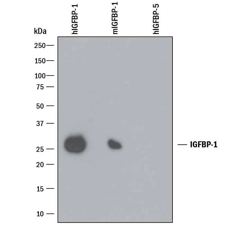 Western blot shows 25 ng of Recombinant Human IGFBP-1 (Catalog # 871-B1), Recombinant Mouse IGFBP-1 (Catalog # 1588-B1) and Recombinant Human IGFBP-5 (Catalog # 875-B5). PVDF Membrane was probed with 1 µg/mL of Mouse Anti-Human IGFBP-1 Monoclonal Antibody (Catalog # MAB675) followed by HRP-conjugated Anti-Mouse IgG Secondary Antibody (Catalog # HAF018). A specific band was detected for IGFBP-1 at approximately 26 kDa (as indicated). This experiment was conducted under non-reducing conditions and using Immunoblot Buffer Group 3.