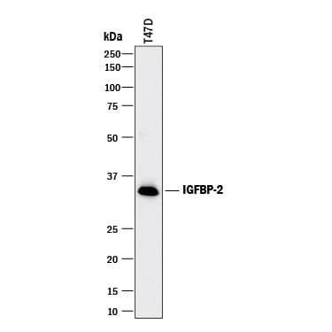 Western Blot IGFBP-2 Antibody [Unconjugated]