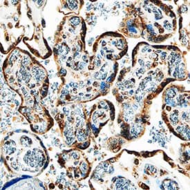 IGFBP-5 was detected in immersion fixed paraffin-embedded sections of human placenta using Goat Anti-Human IGFBP-5 Antigen Affinity-purified Polyclonal Antibody (Catalog # AF875) at 1.7 µg/mL overnight at 4 °C. Tissue was stained using the Anti-Goat HRP-DAB Cell & Tissue Staining Kit (brown; Catalog # CTS008) and counterstained with hematoxylin (blue). Specific staining was localized to syncytiotrophoblasts. View our protocol for Chromogenic IHC Staining of Paraffin-embedded Tissue Sections.