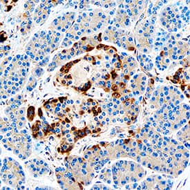 IGFBP-rp1/IGFBP-7 was detected in immersion fixed paraffin-embedded sections of human pancreas using Goat Anti-Human IGFBP-rp1/IGFBP-7 Antigen Affinity-purified Polyclonal Antibody (Catalog # AF1334) at 0.3 µg/mL overnight at 4 °C. Tissue was stained using the Anti-Goat HRP-DAB Cell & Tissue Staining Kit (brown; Catalog # CTS008) and counterstained with hematoxylin (blue). Specific staining was localized to islets. View our protocol for Chromogenic IHC Staining of Paraffin-embedded Tissue Sections.