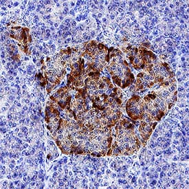 IGFBP-rp1/IGFBP-7 was detected in immersion fixed paraffin-embedded sections of human pancreas using Goat Anti-Human IGFBP-rp1/IGFBP-7 Monoclonal Antibody (Catalog # MAB13341) at 1.7 µg/mL overnight at 4 °C. Tissue was stained using the Anti-Goat HRP-DAB Cell & Tissue Staining Kit (brown; Catalog # CTS008) and counterstained with hematoxylin (blue). Specific staining was localized to islet cell cytoplasm. View our protocol for Chromogenic IHC Staining of Paraffin-embedded Tissue Sections.