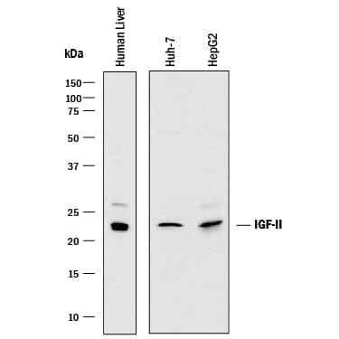 Western blot shows lysates of human liver tissue, Huh-7 human hepatoma cell line, and HepG2 human hepatocellular carcinoma cell line. PVDF membrane was probed with 2 µg/mL of Mouse Anti-Human IGF-II/IGF2 Monoclonal Antibody (Catalog # MAB2921) followed by HRP-conjugated Anti-Mouse IgG Secondary Antibody (Catalog # HAF018). A specific band was detected for IGF-II/IGF2 at approximately 22 kDa (as indicated). This experiment was conducted under reducing conditions and using Immunoblot Buffer Group 1.