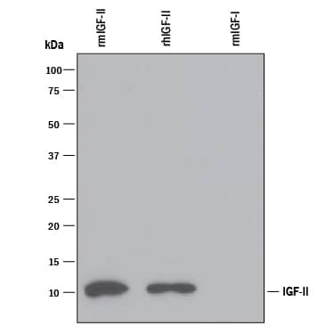Western blot shows 50 ng of Recombinant Mouse IGF-I/IGF1 (Catalog # 791-MG), Recombinant Human IGF-II/IGF2 (Catalog # 292-G2) and Recombinant Mouse IGF-I/IGF1 (Catalog # 791-MG). PVDF Membrane was probed with 1 µg/mL of Rat Anti-Mouse IGF-II/IGF2 Monoclonal Antibody (Catalog # MAB792) followed by HRP-conjugated Anti-Rat IgG Secondary Antibody (Catalog # HAF005). A specific band was detected for IGF-II/IGF2 at approximately 11 kDa (as indicated). This experiment was conducted under reducing conditions and using Immunoblot Buffer Group 3.