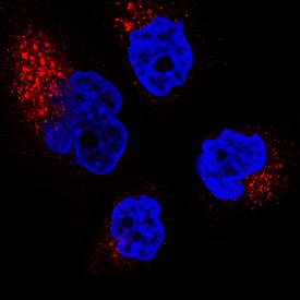 IGF-II R/IGF2R was detected in immersion fixed A172 human glioblastoma cell line using Mouse Anti-Human IGF-II R/IGF2R Monoclonal Antibody (Catalog # MAB2447) at 3 µg/mL for 3 hours at room temperature. Cells were stained using the NorthernLights™ 557-conjugated Anti-Mouse IgG Secondary Antibody (red; Catalog # NL007) and counterstained with DAPI (blue). Specific staining was localized to cytoplasm. View our protocol for Fluorescent ICC Staining of Cells on Coverslips.