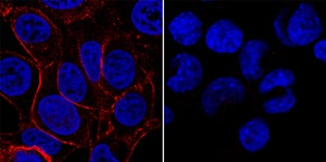 IGF-I R/IGF1R was detected in immersion fixed MCF-7 human breast cancer cell line (positive control, left panel) and HDLM-2 human Hodgkin's lymphoma cell line (negative control, right panel) using Goat Anti-Human/Mouse IGF-I R/IGF1R Antigen Affinity-purified Polyclonal Antibody (Catalog # AF-305-NA) at 1.7 µg/mL for 3 hours at room temperature. Cells were stained using the NorthernLights™ 557-conjugated Anti-Goat IgG Secondary Antibody (red; Catalog # NL001) and counterstained with DAPI (blue). Specific staining was localized to plasma membrane. View our protocols for Fluorescent ICC Staining of Cells on Coverslipsand Fluorescent ICC Staining of Non-adherent Cells.