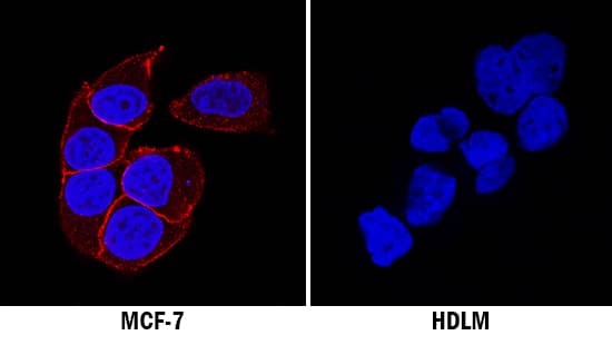 IGF-I R/IGF1R was detected in immersion fixed MCF-7 human breast cancer cell line (positive staining; left panel) and HDLM human Hodgkin's lymphoma cell line (negative staining; right panel) using Mouse Anti-Human/Mouse IGF-I R/IGF1R Monoclonal Antibody (Catalog # MAB391) at 3 µg/mL for 3 hours at room temperature. Cells were stained using the NorthernLights™ 557-conjugated Anti-Mouse IgG Secondary Antibody (red; Catalog # NL007) and counterstained with DAPI (blue). Specific staining was localized to cell membrane in MCF-7 cell line. View our protocol for Fluorescent ICC Staining of Cells on Coverslips.
