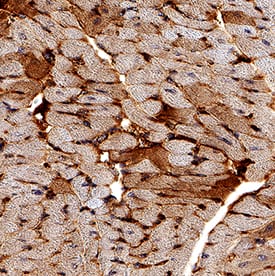 Immunohistochemistry IGF-I R/IGF1R Antibody (33255) [Unconjugated]