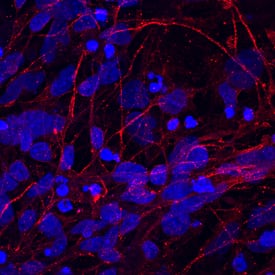 Immunocytochemistry IGSF4B/SynCAM3/CADM3 Antibody [Unconjugated]
