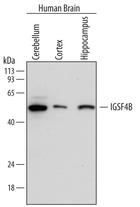 Western blot shows lysates of human brain (cerebellum) tissue, human brain (cortex) tissue, and human brain (hippocampus) tissue. PVDF membrane was probed with 0.2 µg/mL of Mouse Anti-Human IGSF4B/SynCAM3 Monoclonal Antibody (Catalog # MAB3678) followed by HRP-conjugated Anti-Mouse IgG Secondary Antibody (Catalog # HAF007). A specific band was detected for IGSF4B/SynCAM3 at approximately 48 kDa (as indicated). This experiment was conducted under reducing conditions and using Immunoblot Buffer Group 1.