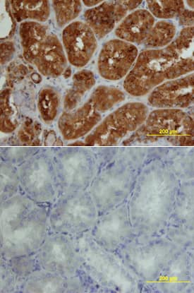 IGSF4C/SynCAM4 was detected in immersion fixed paraffin-embedded sections of human kidney array using Rat Anti-Human IGSF4C/ SynCAM4 Monoclonal Antibody (Catalog # MAB41641) at 15 µg/mL overnight at 4 °C. Tissue was stained using the Anti-Rat HRP-DAB Cell & Tissue Staining Kit (brown; Catalog # CTS017) and counterstained with hematoxylin (blue). Lower panel shows a lack of labeling if primary antibodies are omitted and tissue is stained only with secondary antibody followed by incubation with detection reagents. View our protocol for Chromogenic IHC Staining of Paraffin-embedded Tissue Sections.