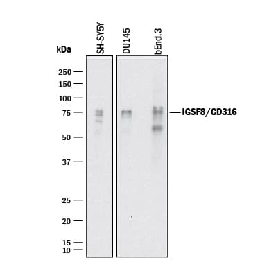 Western blot shows lysates of SH-SY5Y human neuroblastoma cell line, DU145 human prostate carcinoma cell line, and bEnd.3 mouse endothelioma cell line. PVDF membrane was probed with 1 µg/mL of Goat Anti-Human/Mouse/Rat IGSF8/CD316 Antigen Affinity-purified Polyclonal Antibody (Catalog # AF3117) followed by HRP-conjugated Anti-Goat IgG Secondary Antibody (Catalog # HAF017). Specific bands were detected for IGSF8/CD316 at approximately 70-80 kDa (as indicated). This experiment was conducted under reducing conditions and using Immunoblot Buffer Group 1.