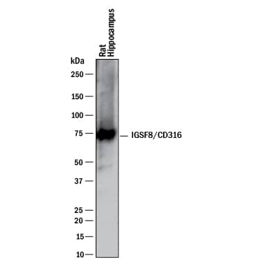 Western blot shows lysates of rat brain (hippocampus) tissue. PVDF membrane was probed with 1 µg/mL of Goat Anti-Human/Mouse/Rat IGSF8/CD316 Antigen Affinity-purified Polyclonal Antibody (Catalog # AF3117) followed by HRP-conjugated Anti-Goat IgG Secondary Antibody (Catalog # HAF017). A specific band was detected for IGSF8/CD316 at approximately 70 kDa (as indicated). This experiment was conducted under reducing conditions and using Immunoblot Buffer Group 1.