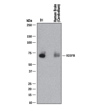 Western blot shows lysates of TT human medullary thyroid cancer cell line and human brain (cerebellum) tissue. PVDF membrane was probed with 2 µg/mL of Rabbit Anti-Human IGSF8/CD316 Monoclonal Antibody (Catalog # MAB3117) followed by HRP-conjugated Anti-Rabbit IgG Secondary Antibody (HAF008). A specific band was detected for IGSF8/CD316 at approximately 70 kDa (as indicated). This experiment was conducted under reducing conditions and using Immunoblot Buffer Group 1.