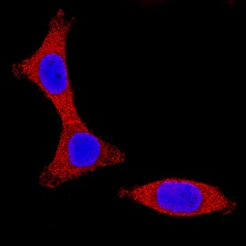IKKa was detected in immersion fixed HCT-116 human colorectal carcinoma cell line using Sheep Anti-Human/Mouse/Rat IKKa Antigen Affinity-purified Polyclonal Antibody (Catalog # AF3768) at 15 µg/mL for 3 hours at room temperature. Cells were stained using the NorthernLights™ 557-conjugated Anti-Sheep IgG Secondary Antibody (red; Catalog # NL010) and counterstained with DAPI (blue). Specific staining was localized to cytoplasmic. View our protocol for Fluorescent ICC Staining of Cells on Coverslips.