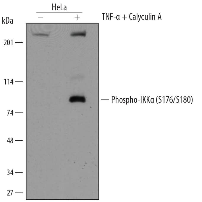 Western blot shows lysates of HeLa human cervical epithelial carcinoma cell line untreated (-) or treated (+) with 100 nM Calyculin A (Catalog # 1336) and 20 ng/mL Recombinant Human TNF-a (Catalog # 210-TA) for 10 minutes. PVDF membrane was probed with 1 µg/mL of Rat Anti-Human Phospho-IKKa (S176/S180) Mono-clonal Antibody (Catalog # MAB3768) followed by HRP-conjugated Anti-Rat IgG Secondary Antibody (Catalog # HAF005). A specific band was detected for Phospho-IKKa (S176/S180) at approximately 90 kDa (as indicated). This experiment was conducted under reducing conditions and using Immunoblot Buffer Group 2.