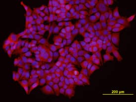 Immunocytochemistry IKK epsilon/IKBKE Antibody (346909) [Unconjugated]