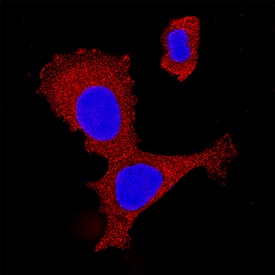 IKK gamma was detected in immersion fixed MCF-7 human breast cancer cell line using Goat Anti-Human/Mouse/Rat IKK gamma Antigen Affinity-purified Polyclonal Antibody (Catalog # AF2684) at 15 µg/mL for 3 hours at room temperature. Cells were stained using the NorthernLights™ 557-conjugated Anti-Goat IgG Secondary Antibody (red; Catalog # NL001) and counterstained with DAPI (blue). Specific staining was localized to cytoplasm. View our protocol for Fluorescent ICC Staining of Cells on Coverslips.