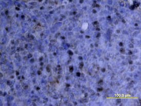 IL-10 was detected in immersion fixed paraffin-embedded sections of human tonsil using Goat Anti-Human IL-10 Antigen Affinity-purified Polyclonal Antibody (Catalog # AF-217-NA) at 15 µg/mL overnight at 4 °C. Tissue was stained using the Anti-Goat HRP-DAB Cell & Tissue Staining Kit (brown; Catalog # CTS008) and counterstained with hematoxylin (blue). View our protocol for Chromogenic IHC Staining of Paraffin-embedded Tissue Sections.