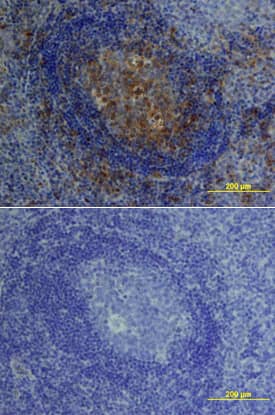 IL-10 was detected in immersion fixed paraffin-embedded sections of human tonsil using Goat Anti-Human IL-10 Antigen Affinity-purified Polyclonal Antibody (Catalog # AF-217-NA) at 15 µg/mL overnight at 4 °C. Tissue was stained using the Anti-Goat HRP-DAB Cell & Tissue Staining Kit (brown; Catalog # CTS008) and counterstained with hematoxylin (blue). Lower panel shows a lack of labeling if primary antibodies are omitted and tissue is stained only with secondary antibody followed by incubation with detection reagents. View our protocol for Chromogenic IHC Staining of Paraffin-embedded Tissue Sections.