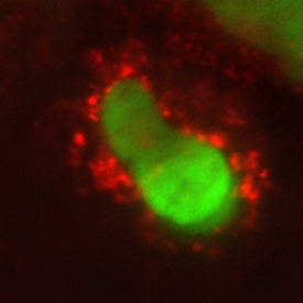 IL‑10 R alpha  was detected in immersion fixed human peripheral blood mononuclear cells (PBMCs) using 15 µg/mL Goat Anti-Human IL‑10 R alpha  Antigen Affinity-purified Polyclonal Antibody (Catalog # AF‑274‑NA) for 3 hours at room temperature. Cells were stained (red) and counterstained (green). View our protocol for Fluorescent ICC Staining of Non-adherent Cells.