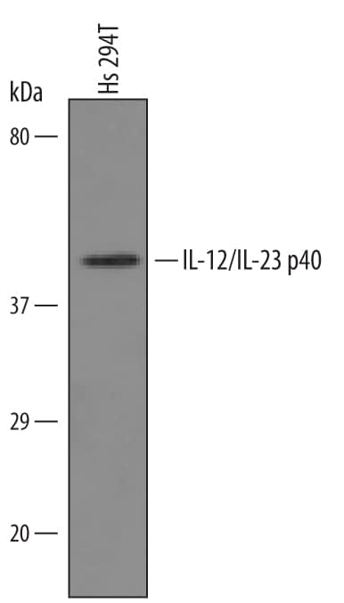 Western blot shows lysates of Hs 294T human melanoma cell line. PVDF Membrane was probed with 1 µg/mL of Goat Anti-Human IL-12/IL-23 p40 Antigen Affinity-purified Polyclonal Antibody (Catalog # AF309) followed by HRP-conjugated Anti-Goat IgG Secondary Antibody (Catalog # HAF019). A specific band was detected for IL-12/IL-23 p40 at approximately 40 kDa (as indicated). This experiment was conducted under reducing conditions and using Immunoblot Buffer Group 8.