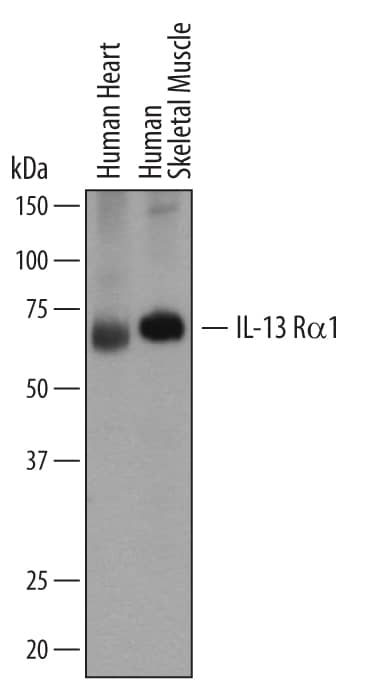 Western blot shows lysates of human heart tissue and human skeletal muscle tissue. PVDF membrane was probed with 2 µg/mL of Mouse Anti-Human IL-13 Ra1 Monoclonal Antibody (Catalog # MAB1462) followed by HRP-conjugated Anti-Mouse IgG Secondary Antibody (Catalog # HAF007). A specific band was detected for IL-13 Ra1 at approximately 65 kDa (as indicated). This experiment was conducted under reducing conditions and using Immunoblot Buffer Group 1.