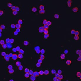 IL-13 Ra2 was detected in immersion fixed mouse splenocytes using Mouse IL-13 Ra2 Antigen Affinity-purified Polyclonal Antibody (Catalog # AF539) at 10 µg/mL for 3 hours at room temperature. Cells were stained using the NorthernLights™ 557-conjugated Anti-Goat IgG Secondary Antibody (red; Catalog # NL001) and counterstained with DAPI (blue). View our protocol for Fluorescent ICC Staining of Non-adherent Cells.